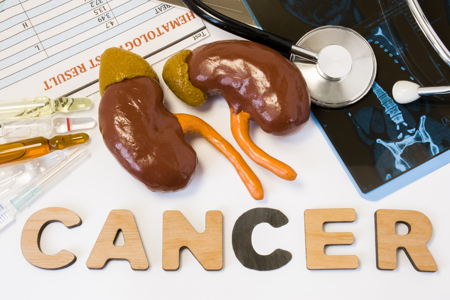 Causes of Kidney Cancer